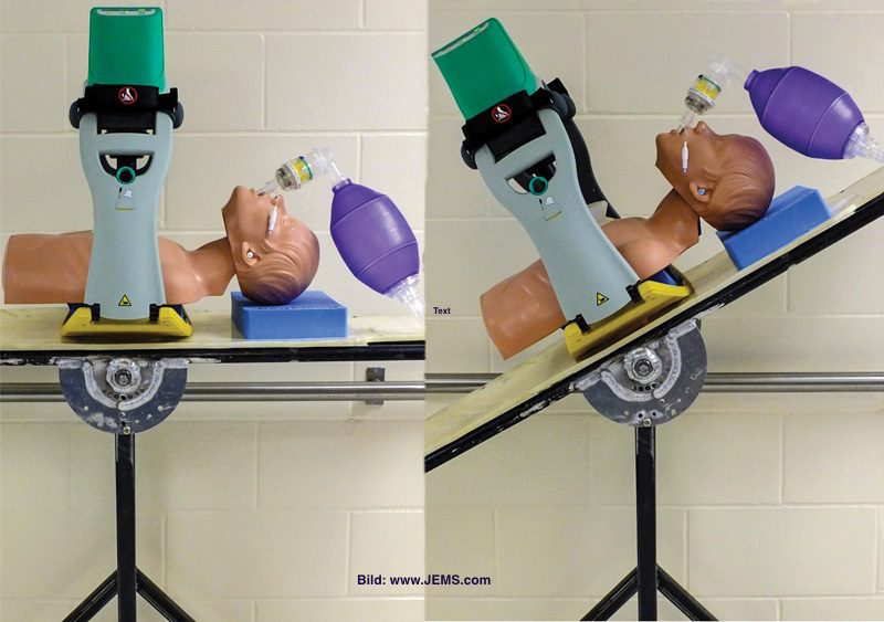 Head up CPR – Ergebnisse aus Beobachtungsstudie