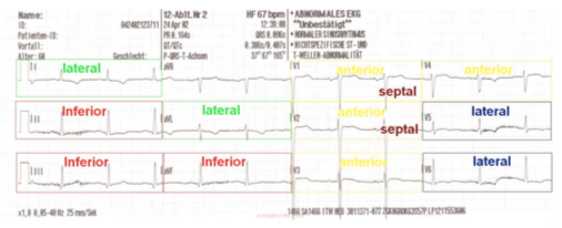 Bildschirmfoto 2018-02-06 um 07.44.30