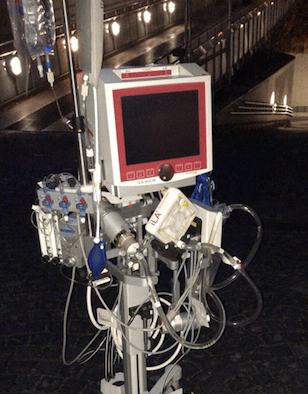 ECMO – was ist das&nbsp;eigentlich?